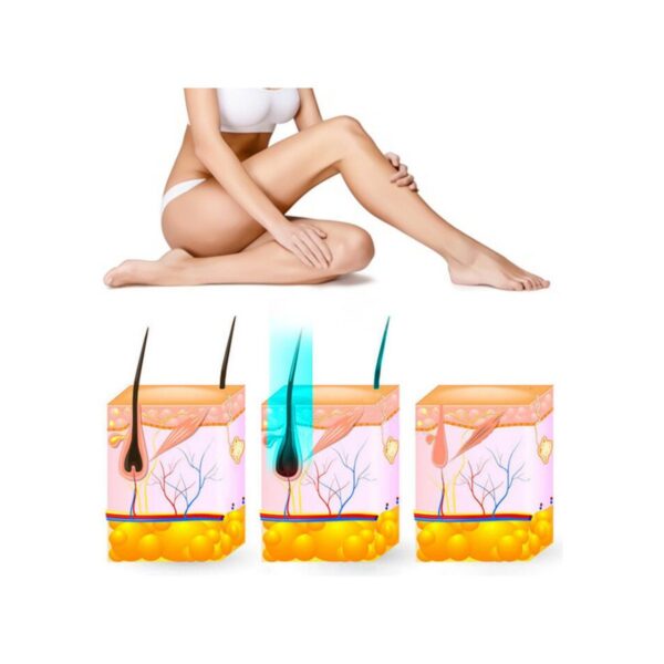 Yui IPLV15 Pro Vücut -Yüz- Bikini Başlıklı Ağrısız Otomatik ve Manuel Atım Buz Lazer Epilasyon Cihazı